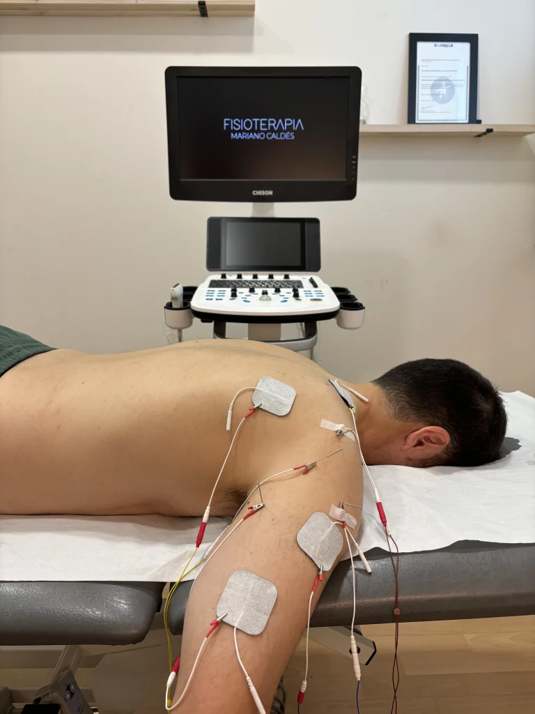 Tratamiento de neuromodulación percutánea ecoguiada en su clínica de fisioterapia en Las Rozas.